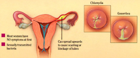 Da li oralni seks utjece na grcenje maternice