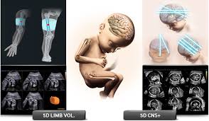5D/4D ultrazvuk u Sarajevu sa opcijama za 5D pregled mozga i koštanog sistema fetusa